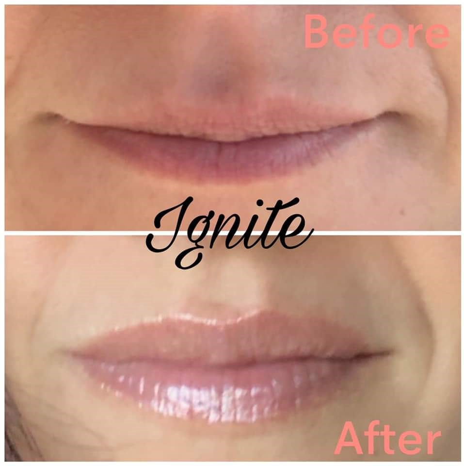 Ignite - Lip Plumper and Conditioner